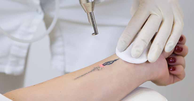 Are Tattoos Safe and Sound? Health Implications of Getting a Tattoo Done