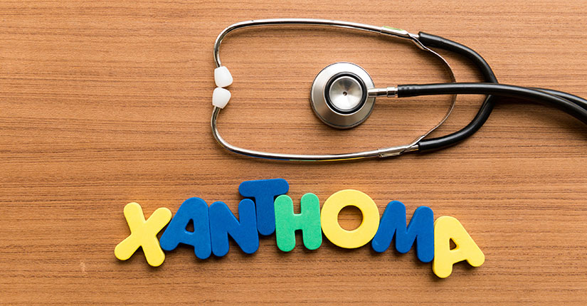 A To Z of Health – “X” is to know about Xanthoma