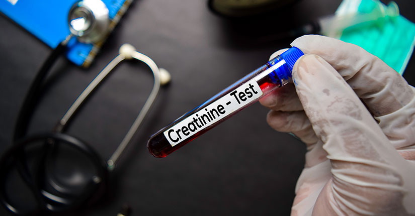 High Creatinine Levels- Causes, Treatment & Management