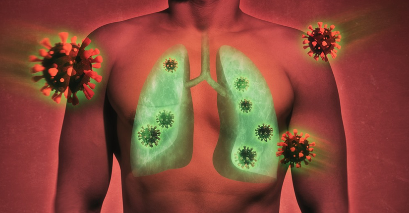 COVID-19 and Lung Damage- What’s the Correlation?