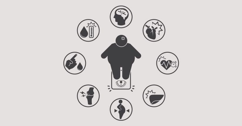 How Obesity Affects Life Expectancy?
