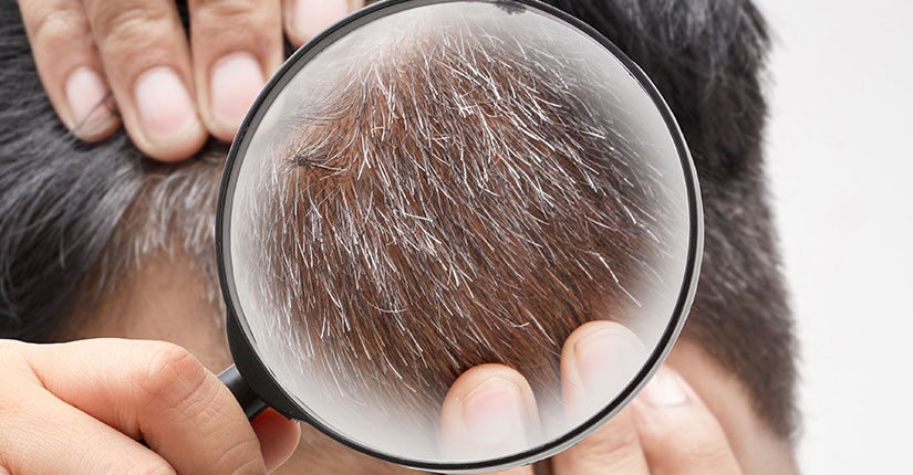 Feeding Smart from the Start to Prevent Premature Greying