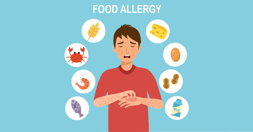 5 Signs of Food Allergies and Its Prevention
