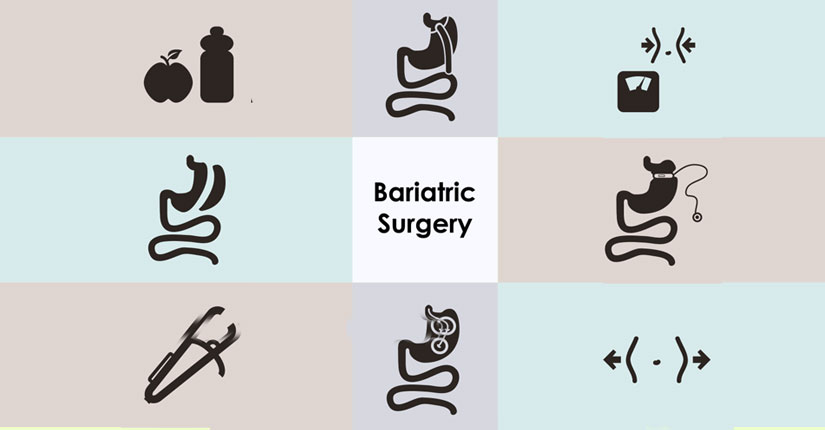 Bariatric Surgery: Know What It Is and Its Unforseen Consequences