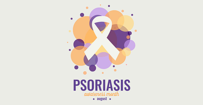 5 Psoriasis Triggers And How To Handle Flare-Ups