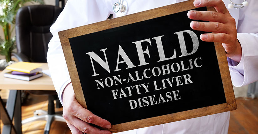 4 Diagnostic Indicators Of Non-Alcoholic Fatty Liver Disease