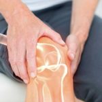 A good diet is the best management for arthritis that no one knows