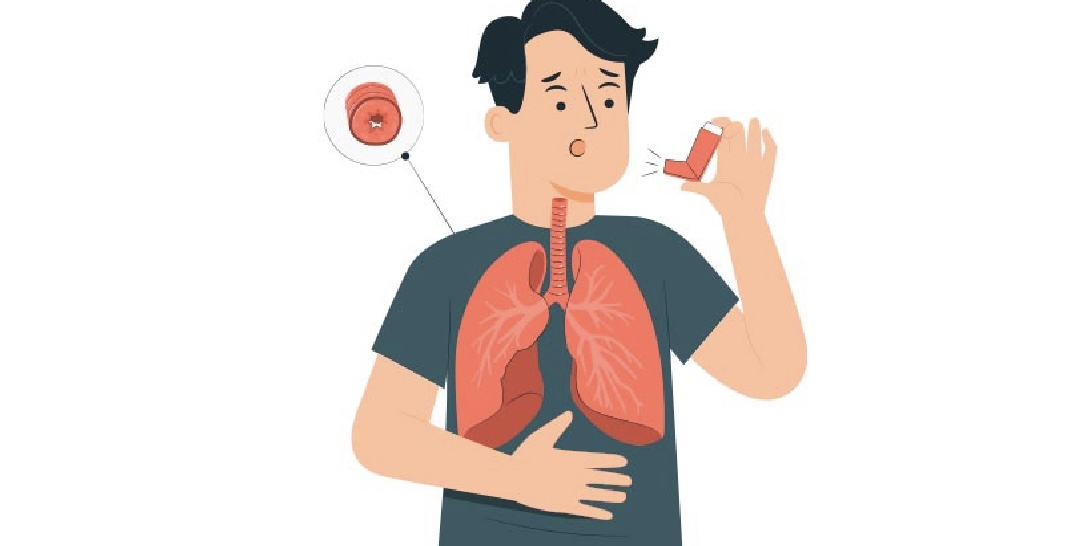 3 Ways summer and humidity affects asthma! Nmami Life