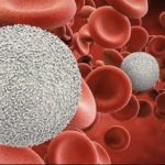 LEUKEMIA AND LYMPHOMA: BLOOD CANCER AND ITS TERMS EXPLAINED